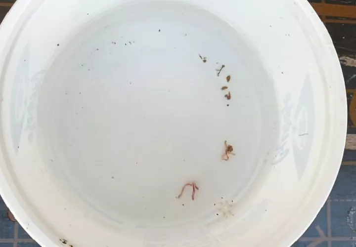 La residente Keny Arcia denunció que el agua potable llega acompañada de lombrices y advirtió que en la zona ya se registran casos de diarrea. Foto. Melquíades Vásquez