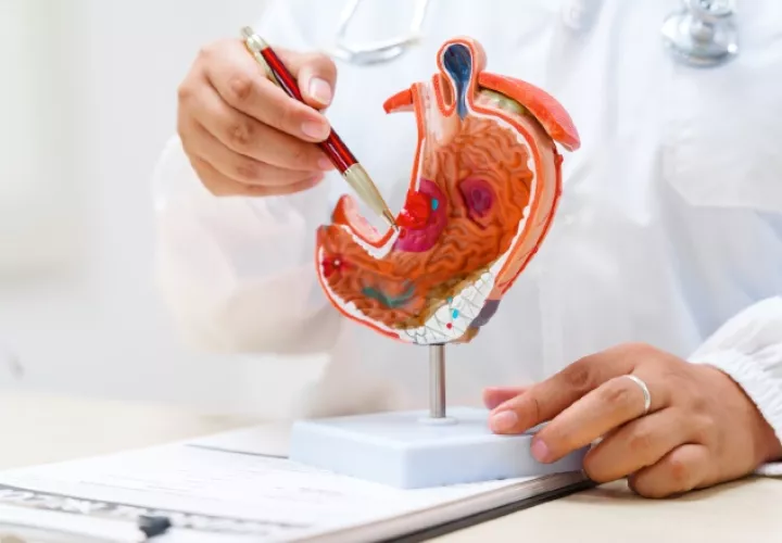 Panamá registra más de 620 de este tipo de cáncer al año. Foto: Cortesía