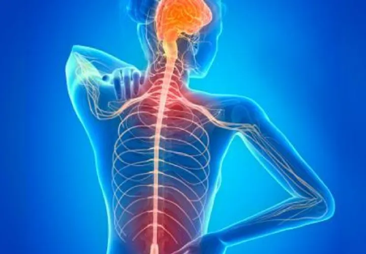 A nivel mundial 2.3 millones de personas padecen de esclerosis múltiple mal crónico inflamatorio que afecta al sistema nervioso central. Foto: Pixabay