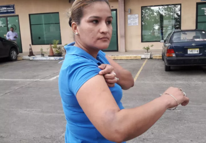 La otra mujer fue golpeada en el brazo por policías en Chiriquí. 
