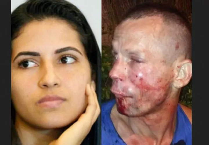  Polyana Viana le destrozó el rostro al supuesto delincuente. Foto @danawhite