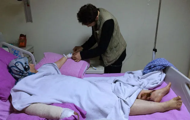 Civil herida por los ataques rusos en Siria. Foto/ AP