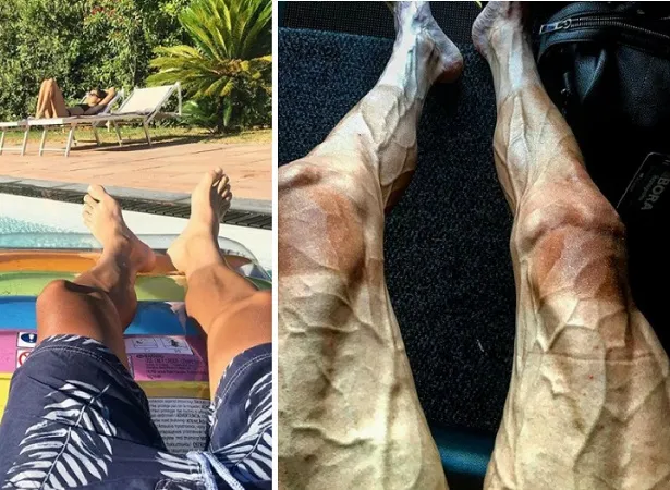 Poljanski con la piernas normales vs. después  de 16 etapas.